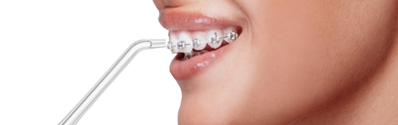 Ирригатор USMILE CY1.jpg